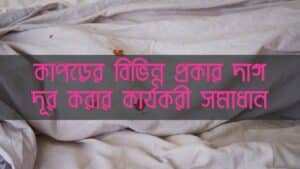কাপড়ের দাগ দূর করার কার্যকরী উপায়